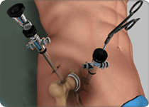 Arthroscopic Surgery